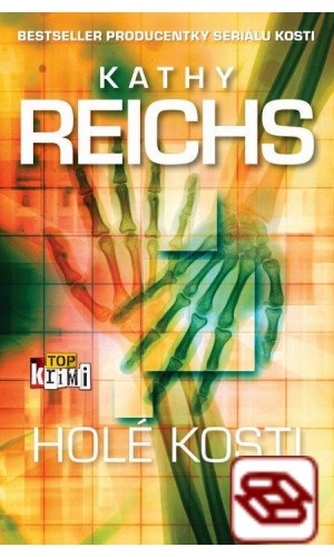 Holé kosti