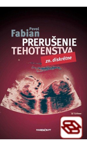 Prerušenie tehotenstva